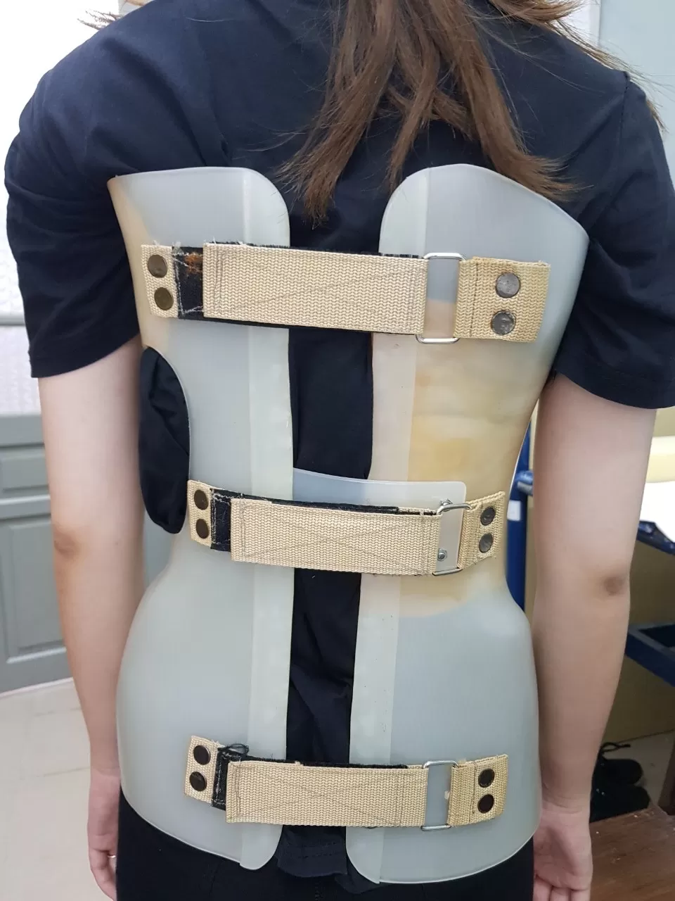 Vật liệu nhựa cho ngành chỉnh hình (Orthopaedics & Medical Devices) – Giải pháp nâng cao chất lượng cuộc sống