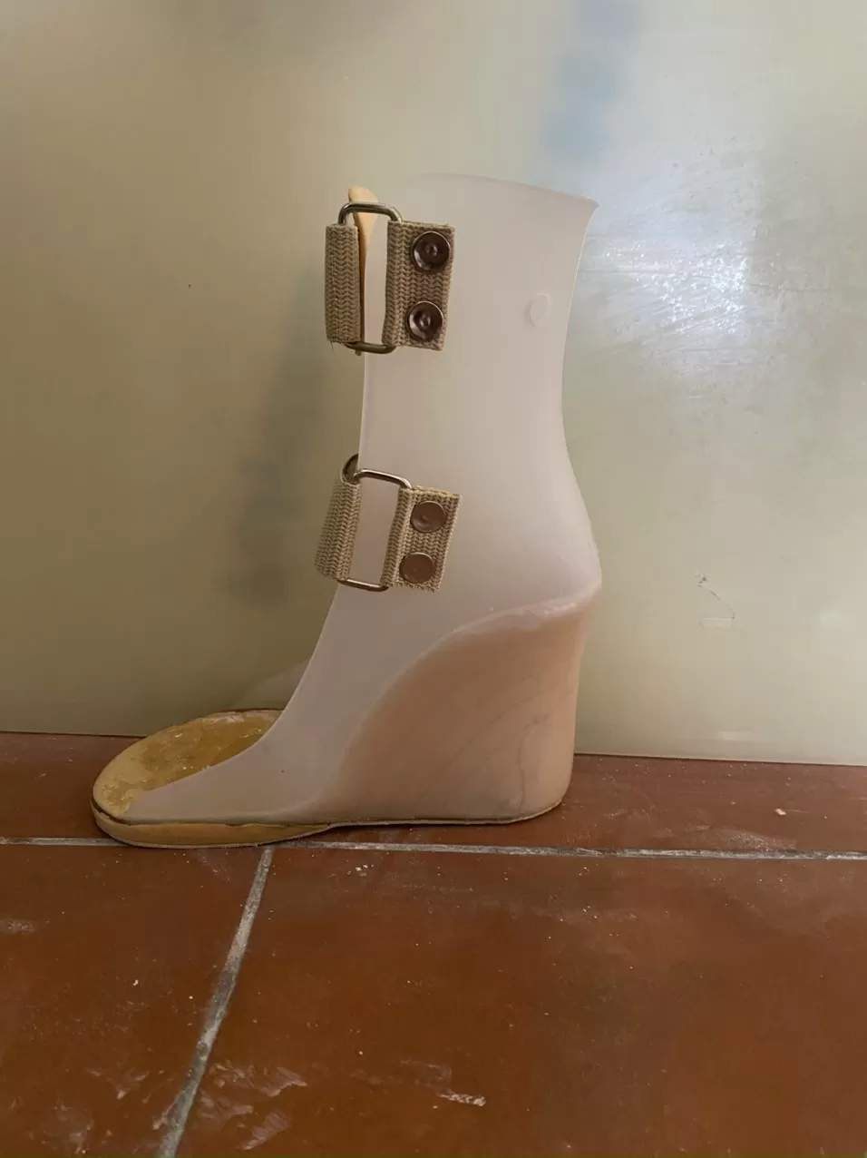 Vật liệu nhựa cho ngành chỉnh hình (Orthopaedics & Medical Devices) – Giải pháp nâng cao chất lượng cuộc sống